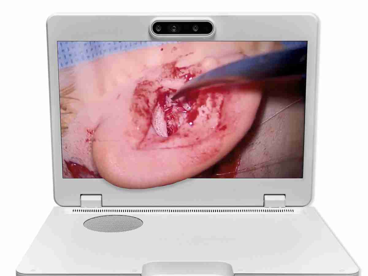 达擎之＂Heads-up 3D显微手术显示系统＂，，，，整合4K裸眼3D显示及眼球追踪系统，，具备快速追踪人眼移动位置功能，，减轻医师长时间维持固定姿势的负担，，让医师能有更宽广清晰的3D立体视野及更舒适的姿势来执行手术。。。